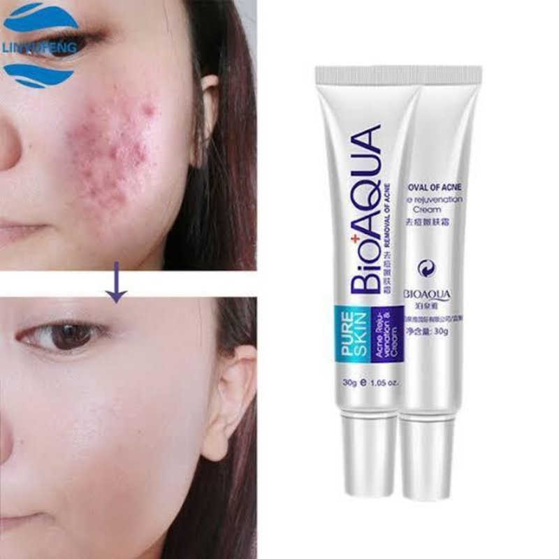 Premium Acne Removal Cream 30g All Skin Types - thumbnail 2